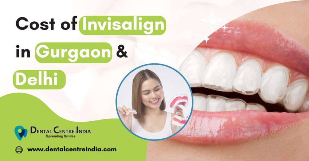 Invisalign in Gurgaon | Cost  of  Invisalign in Gurgaon & Delhi