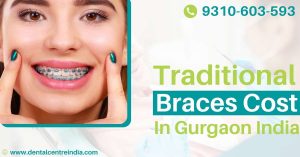 Read more about the article Traditional Braces Cost In Gurgaon, India