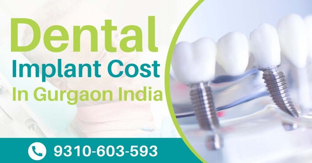 Dental Implant Cost In Gurgaon, India