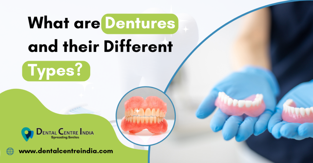 What are Dentures and their Different Types?