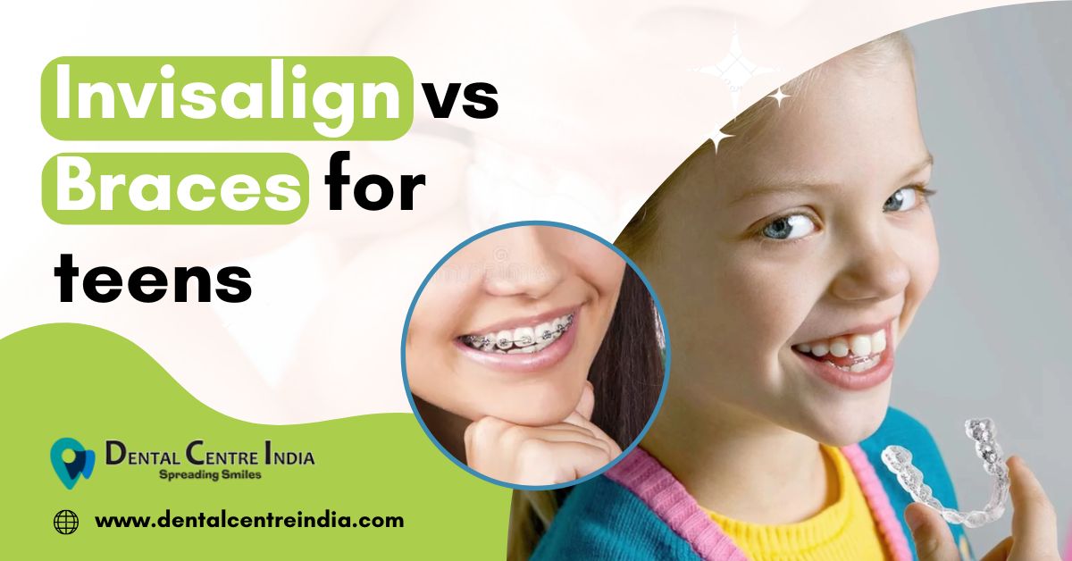 Read more about the article Invisalign vs Braces for teens