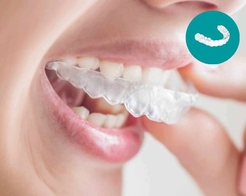 Dental Centre India Invisible Braces