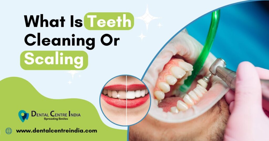 What Is Teeth Cleaning Or Scaling