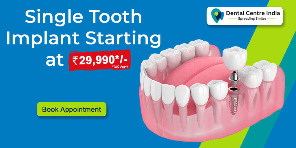 Single Tooth Implant Starting at 29,990 at Dental Centre India | Best Dental Clinic in Gurgaon | Best Dental Implant Clinic in Gurugram