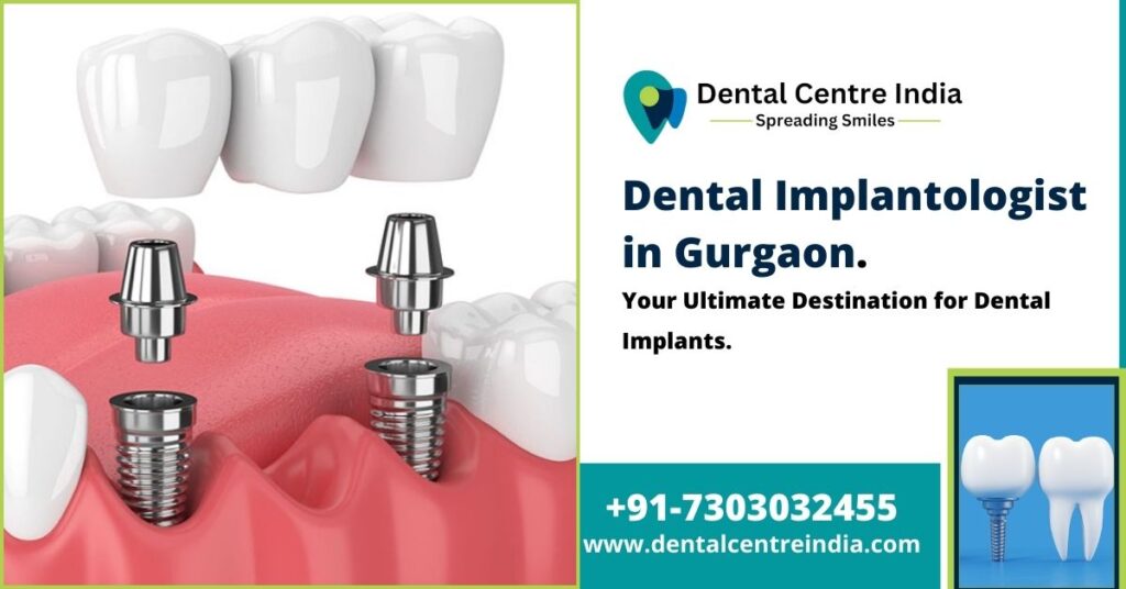 Dental Implants in Gurgaon | Dental Centre India